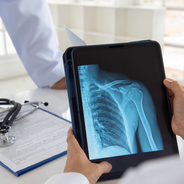 oncologia ortopédica